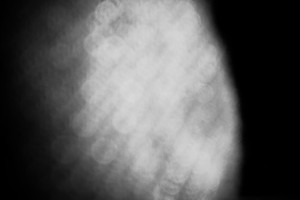 Several shades of grey (Jan 2015)